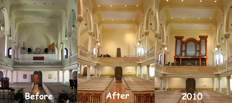 organ-before-during-and-after